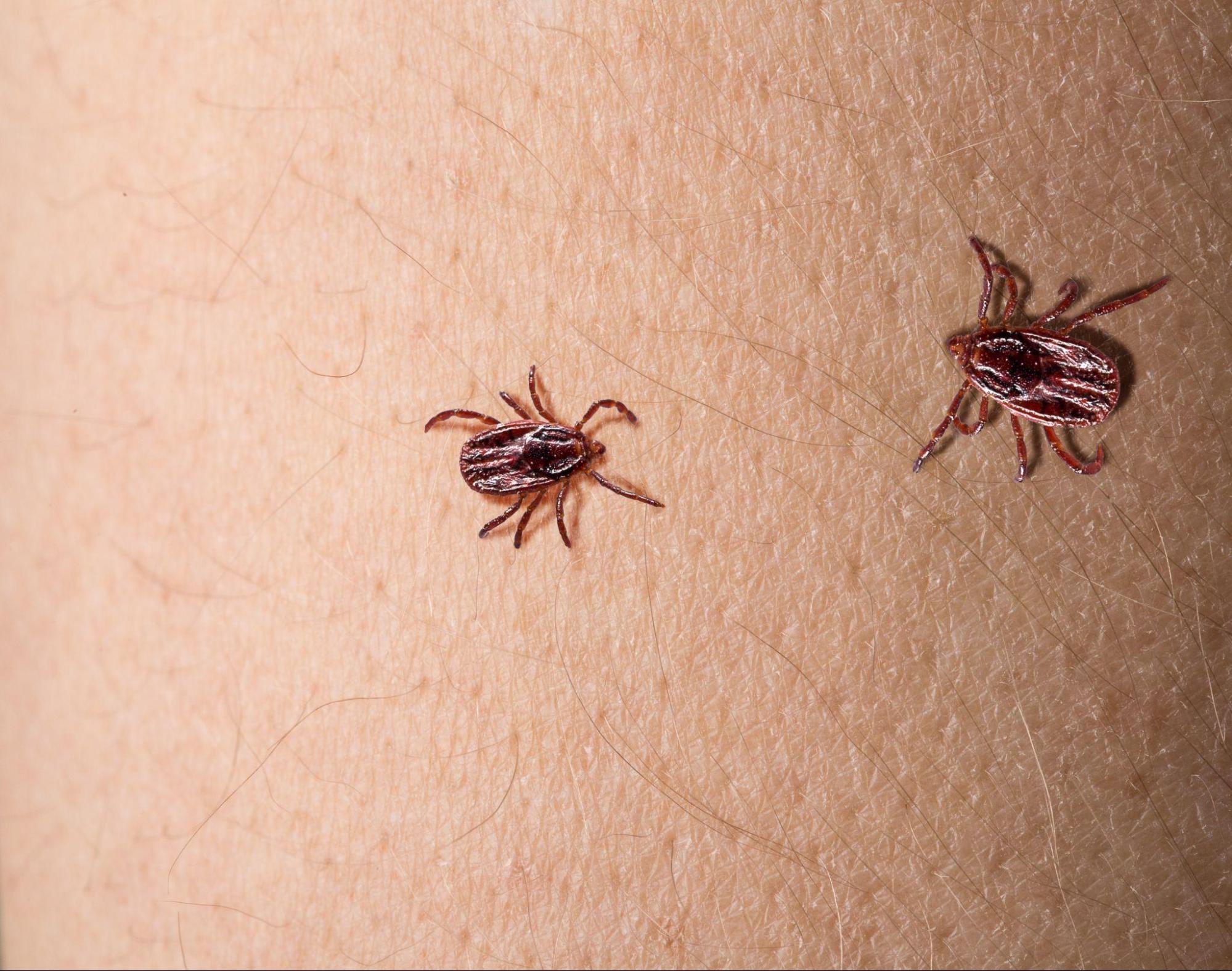 Close-up of ticks crawling on human skin, showing a possible cause of itching that may be confused with symptoms needing scabies itch treatment. 