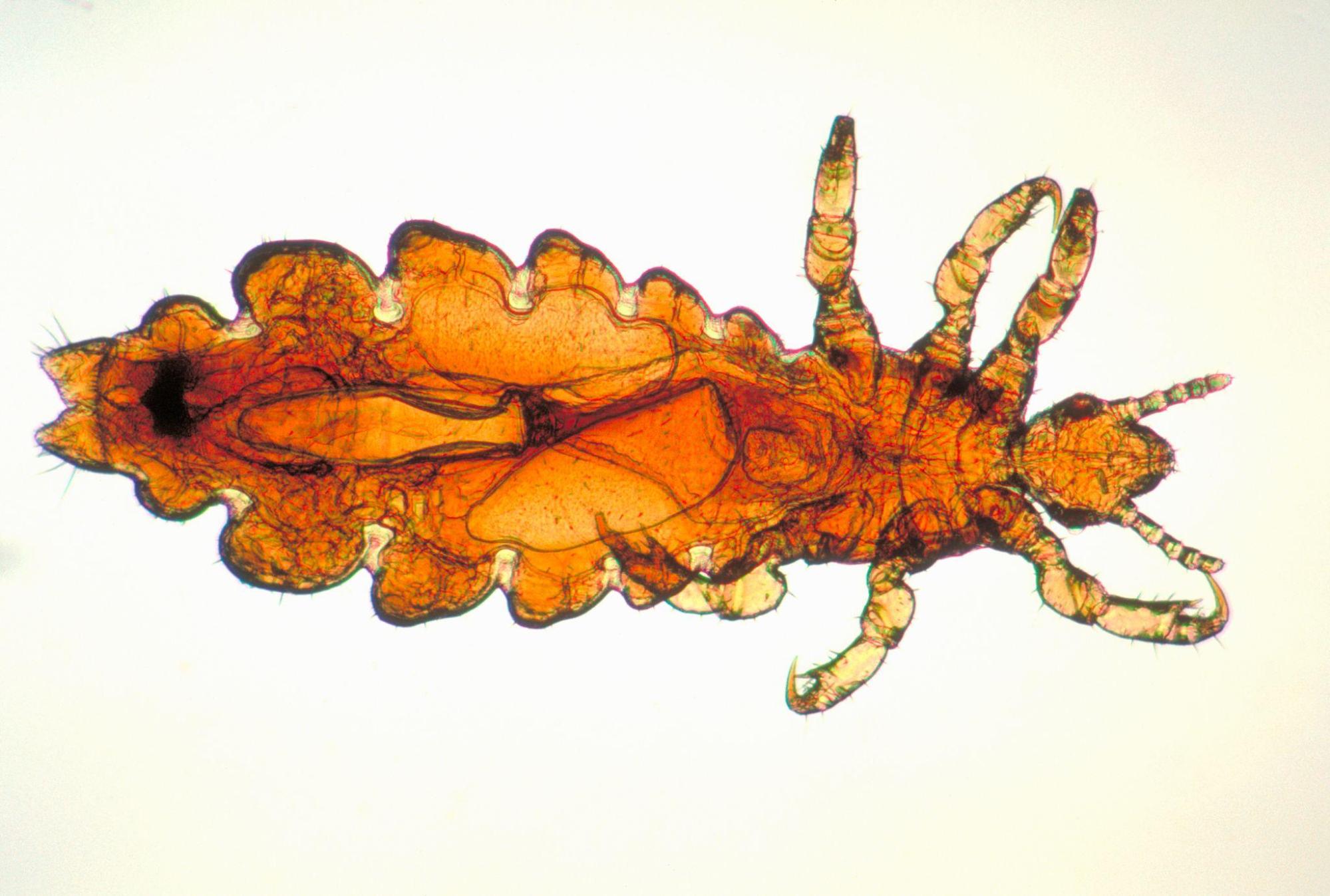 Microscopic view of a head louse, showing the parasite responsible for head lice and the need for proper lice eggs removal.