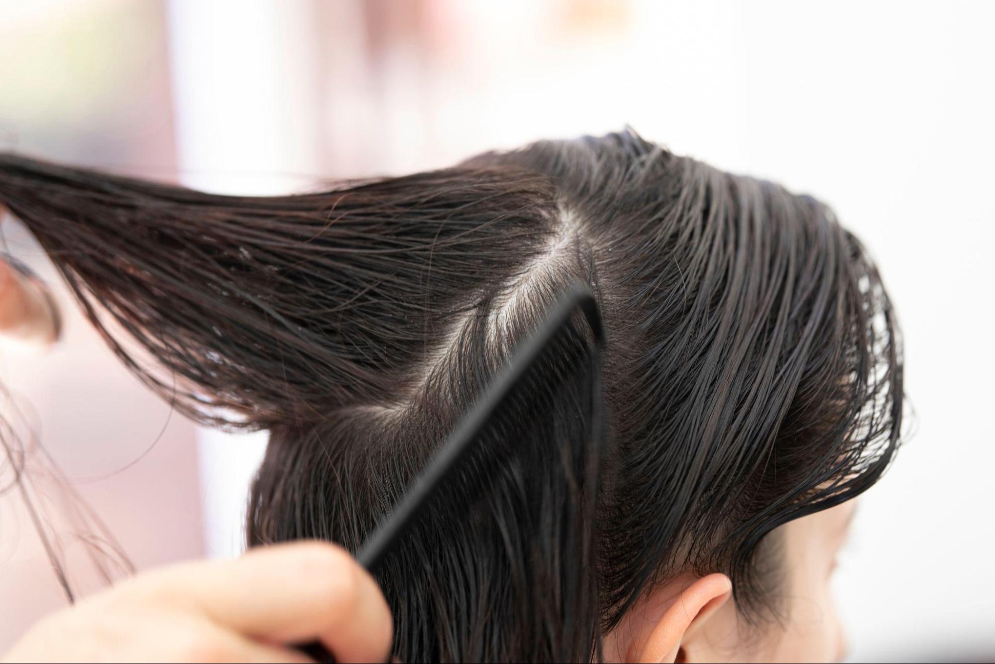 Wet hair divided into small sections for careful combing during the lice eggs removal process.