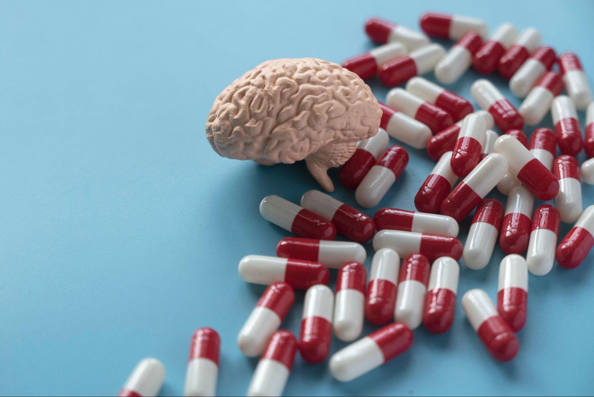 Brain model surrounded by medication capsules, illustrating how ketamine affects the brain and its connection to depression treatment. 